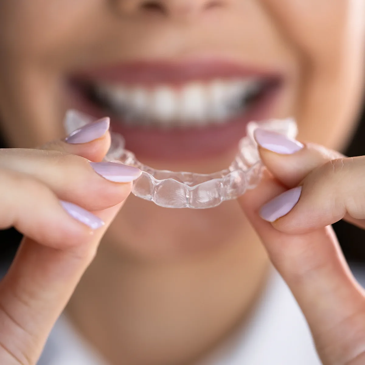Houston Invisalign