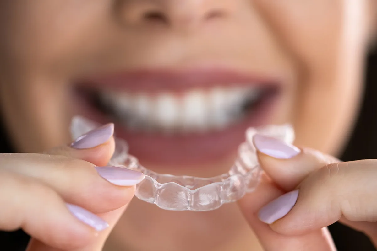 Invisalign in Houston